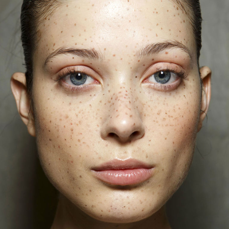 5499c0f8cd51b_-_hbz-lfw-ss2015-beauty-preen-freckles-promo